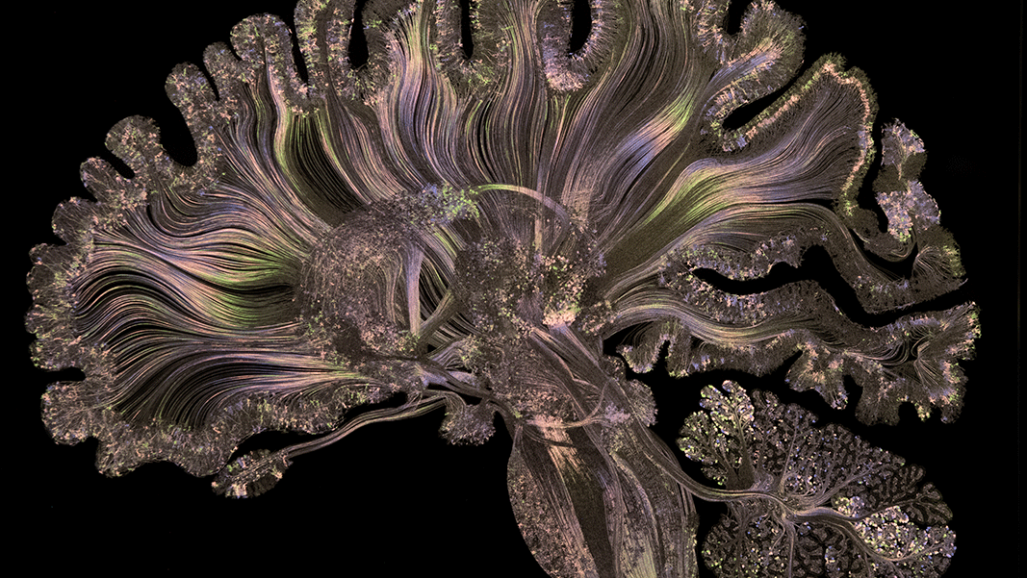 'Cerebro(s)', en Madrid